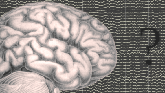 Hersenen, een vraagteken en drie emoji's van een gezicht