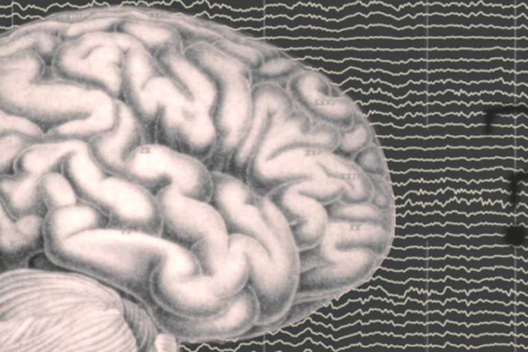 Hersenen, een vraagteken en drie emoji's van een gezicht